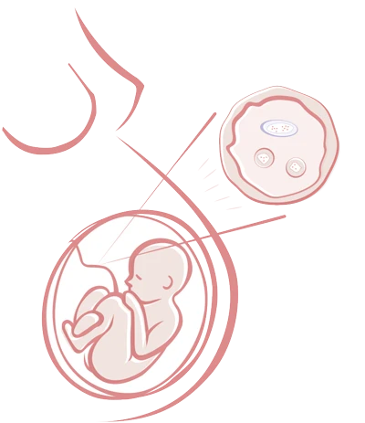 Ilustração de feto no útero com zoom no cordão umbilical